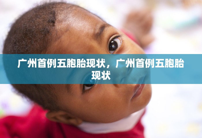 广州首例五胞胎现状，广州首例五胞胎现状
